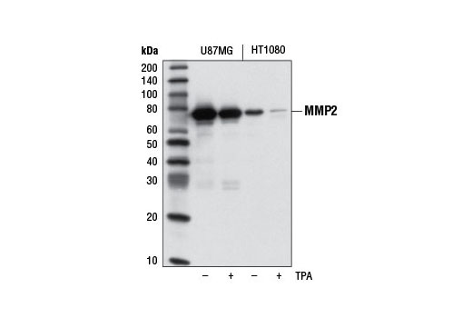 Western blot analysis of concentrated, serum-free cultured medium from U-87 MG and HT-1080 cells, untreated (-) or treated with TPA (12-O-Tetradecanoylphorbol-13-Acetate) #4174 (200 nM; +), using MMP-2 (D8N9Y) Rabbit mAb.