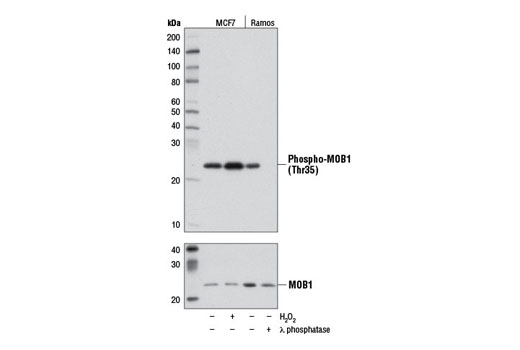 Western blot analysis of extracts from MCF7 cells, either untreated (-) or treated (+) with H 2 O 2 (2.5 mM, 30 min) and Ramos cells, either untreated (-) or treated (+) with λ phosphatase, using Phospho-MOB1 (Thr35) (D2F10) Rabbit mAb (upper) and MOB1 Antibody #3863 (lower).