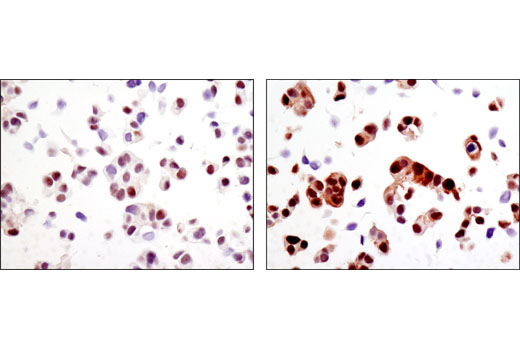 Immunohistochemical analysis of paraffin-embedded MCF7 cell pellets, control (left) or H2O2-treated (right), using Phospho-MOB1 (Thr35) (D2F10) Rabbit mAb.