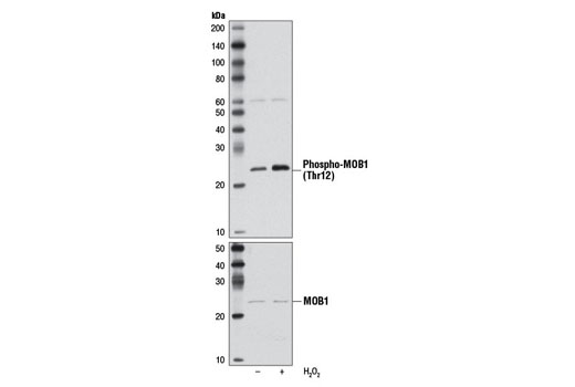 Western blot analysis of extracts from MCF7 cells, untreated or H 2 O 2 -treated (2.5 mM, 30 min), using Phospho-MOB1 (Thr12) (D2E3) Rabbit mAb (upper) and MOB1 Antibody #3863 (lower).