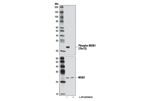 Western blot analysis of extracts from Ramos cells, untreated or λ phosphatase-treated, using Phospho-MOB1 (Thr12) (D2E3) Rabbit mAb (upper) and MOB1 Antibody #3863 (lower).