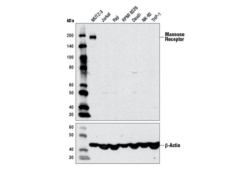 Western blot analysis of extracts from various cell lines using Mannose Receptor Antibody (upper) and β-Actin (D6A8) Rabbit mAb #8457 (lower).