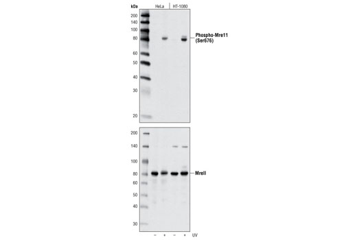 Western blot analysis of extracts from HeLa and HT-1080 cells, untreated or treated with UV, using Phospho-Mre11 (Ser676) Antibody (upper) or total Mre11 Antibody #4895 (lower).