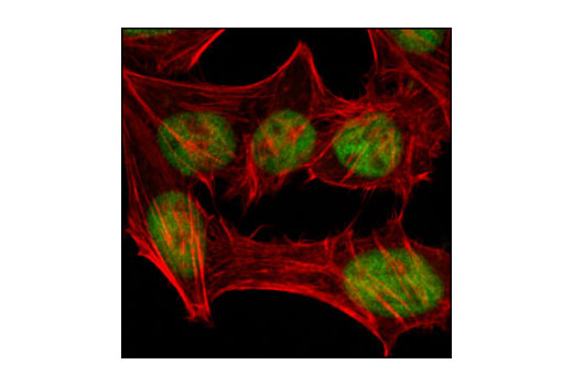 Confocal immunofluorescent analysis of HeLa cells using MSH2 (3A2) Mouse mAb (green). Actin filaments have been labeled with DY554 phalloidin (red).