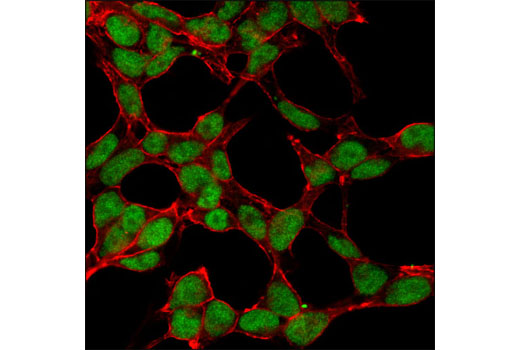 Confocal immunofluorescent analysis of 293 cells using MSH6 (D60G2) XP ® Rabbit mAb (green). Actin filaments were labeled with DY-554 phalloidin (red).