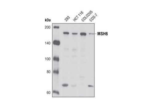 Western blot analysis of extracts from various cell types using MSH6 (L990) Antibody.