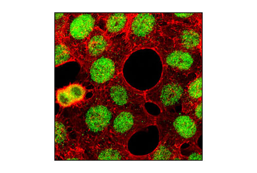 Confocal immunofluorescent analysis of HCT-116 cells using MSH6 (L990) Antibody (green). Actin filaments have been labeled using DY-554 phalloidin (red).