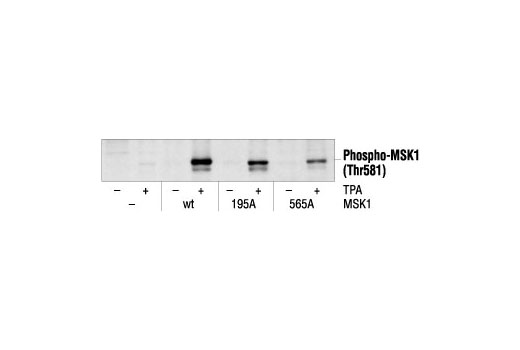 Western blot analysis of extracts from 293 cells, transfected with wt MSK1 or mutant MSK1, untreated or TPA-treated (200 nM), using Phospho-MSK1 (Thr581) Antibody.