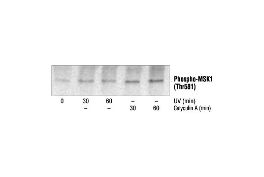 Western blot analysis of extracts from 293 cells, untreated, UV-treated or calyculin A-treated, using Phospho-MSK1 (Thr581) Antibody.