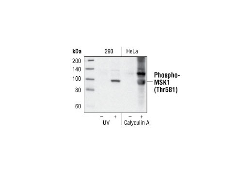 Western blot analysis of extracts from 293 cells untreated or treated with UV and HeLa cells untreated or treated with calyculin A, using Phospho-MSK1 (Thr581) Antibody.
