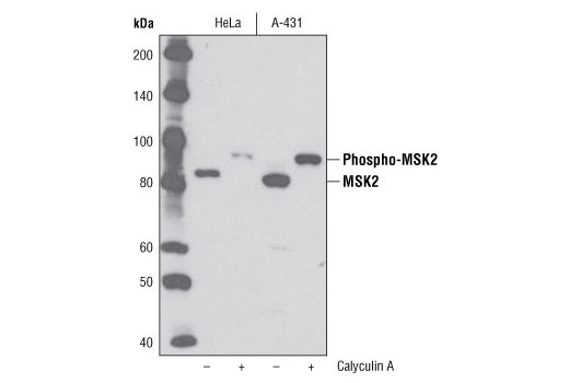 Western blot analysis of extracts from HeLa and A-431 cells, untreated or treated with Calyculin A #9902 (100 nM, 30 minutes), using MSK2 (D41A4) XP ® Rabbit mAb.