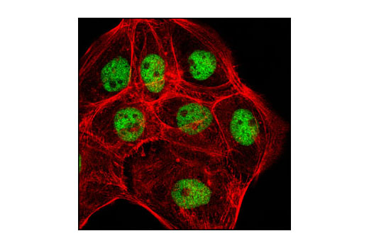 Confocal immunofluorescent analysis of A-431 cells using MSK2 (D41A4) XP ® Rabbit mAb (green). Actin filaments have been labeled with DY-554 phalloidin (red). Blue pseudocolor = DRAQ5 ® #4084 (fluorescent DNA dye).