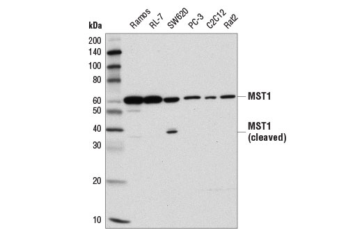 Western blot analysis of extracts from various cell lines using MST1 (D8B9Q) Rabbit mAb.