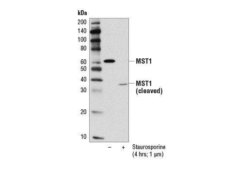Western blot analysis of extracts from HeLa cells, serum-starved overnight and then vehicle treated (-) or treated with Staurosporine #9953 (1 μM, 4 hr; +), using MST1 (D8B9Q) Rabbit mAb. Staurosporine induces caspase-mediated cleavage of full-length MST1, yielding a 37 kDa amino-terminal fragment detected by this antibody, and an undetected 18 kDa carboxy-terminal fragment.
