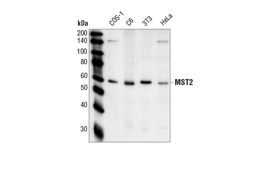 Western blot analysis of extracts from various cell lines using MST2 Antibody.