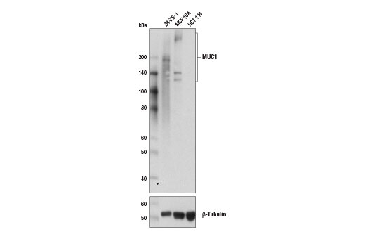 Western blot analysis of extracts from ZR-75-1, MCF 10A, and HCT 116 cells using MUC1 (D9O8K) XP ® Rabbit mAb (upper) and β-Tubulin Antibody #2146 (lower).