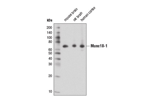 Western blot analysis of extracts from mouse brain, rat brain, and human cortex using Munc18-1 (D4O6V) Rabbit mAb.