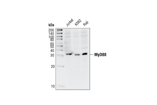 Western blot analysis of extracts from Jurkat, K562 and Raji cells, using MyD88 Antibody.