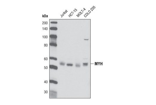 Western blot analysis of extracts from various cell types using MYH Antibody.