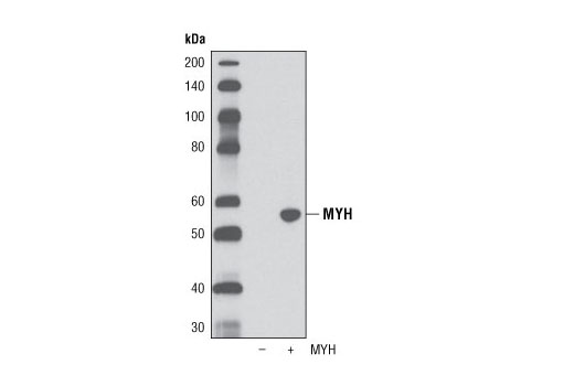 Western blot analysis of extracts from COS-7 cells, mock transfected (-) or MYH-transfected (+), using MYH Antibody.