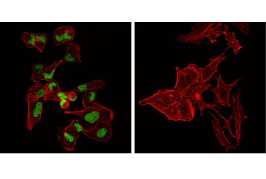 Confocal immunofluorescent analysis of RH30 (positive, left), and HeLa (negative, right) cells using MyoD (D8G3) XP ® Rabbit mAb (green). Actin filaments were labeled with DyLight™ 554 Phalloidin #13054 (red).