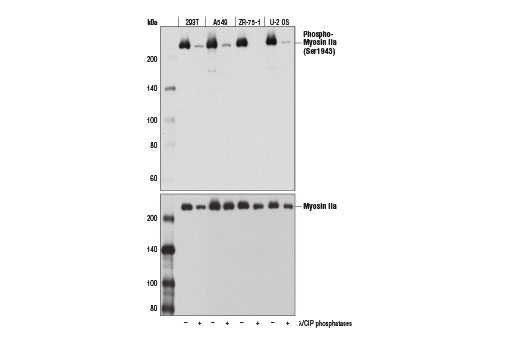 Western blot analysis of extracts from various cell lines, untreated (-) or treated with λ phosphatase and calf intestinal phosphatase (CIP; +), using Phospho-Myosin IIa (Ser1943) (D7Z7T) Rabbit mAb (upper) and Myosin IIa Antibody #3403 (lower).