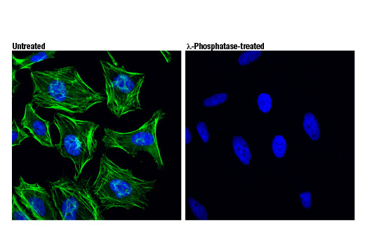 Confocal immunofluorescent analysis of HeLa cells, untreated (left) or λ phosphatase-treated (right), using Phospho-Myosin IIa (Ser1943) (D7Z7T) Rabbit mAb (green). Blue pseudocolor = DRAQ5 ® #4084 (fluorescent DNA dye).