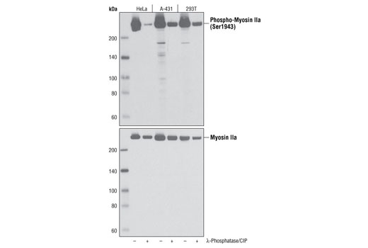 Western blot analysis of extracts from HeLa, A-431 and 293T cells, untreated or treated with λ phosphatase and calf intestinal phosphatase (CIP), using Phospho-Myosin IIa (Ser1943) Antibody (upper) or Myosin IIa Antibody #3403 (lower).