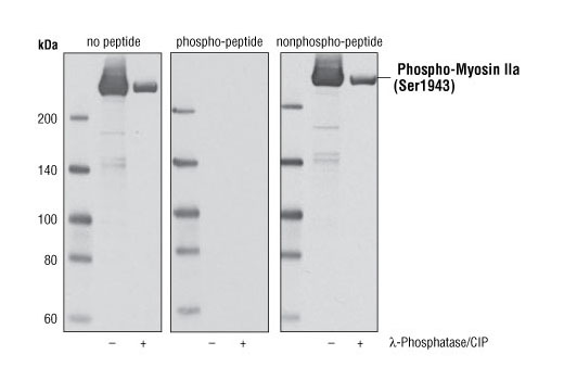 Western blot analysis of extracts from A-431 cells, untreated or treated with λ phosphatase and calf intestinal phosphatase (CIP), using Phospho-Myosin IIa (Ser1943) Antibody. The antibody was pre-incubated with peptides corresponding to unphosphorylated Myosin IIa or Myosin IIa phosphorylated at Ser1943, as indicated.