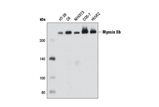Western blot analysis of extracts from various cell types using Myosin IIb (D8H8) XP ® Rabbit mAb.