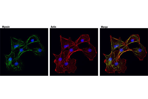 Confocal immunofluorescent analysis of COS-7 cells using Myosin IIb (D8H8) XP ® Rabbit mAb (green). Actin filaments were labeled with DY-554 phalloidin (red). Blue pseudocolor = DRAQ5 ® #4084 (fluorescent DNA dye).
