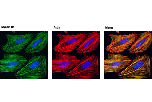 Confocal immunofluorescent analysis of HeLa cells using Myosin IIa Antibody (green) showing colocalization with actin filaments that have been labeled with DY-554 phalloidin (red). Blue pseudocolor = DRAQ5™ (fluorescent DNA dye).