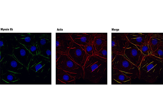 Confocal immunofluorescent analysis of Cos cells using Myosin IIb Antibody (green). Actin filaments have been labeled with DY-554 phalloidin (red). Blue pseudocolor = DRAQ5™ (fluorescent DNA dye).