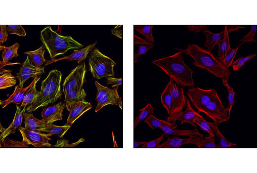 Confocal immunofluorescent images of HeLa cells, untreated (left) or phosphatase-treated (right), labeled with Phospho-Myosin Light Chain 2 (Ser19) Antibody (green). Actin filaments have been labeled with Alexa Fluor® 555 phalloidin (red). Blue pseudocolor = DRAQ5 ® #4084 (fluorescent DNA dye).