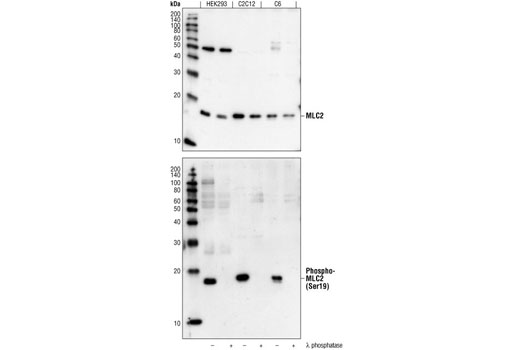 Western blot analysis of extracts from HEK293, C2C12, and C6 cells, untreated (-) or lamda phosphatase treated (+), using Myosin Light Chain 2 Antibody #3672 (upper) or Phospho-Myosin Light Chain 2 (Ser19) Mouse mAb (lower).