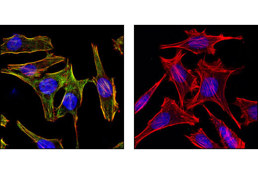 Confocal immunofluorescent images of HeLa cells, untreated (left) or phosphatase-treated (right), labeled with Phospho-Myosin Light Chain 2 (Ser19) Mouse mAb (green). Actin filaments have been labeled with Alexa Fluor® 555 phalloidin (red). Blue pseudocolor = DRAQ5® #4084 (fluorescent DNA dye).