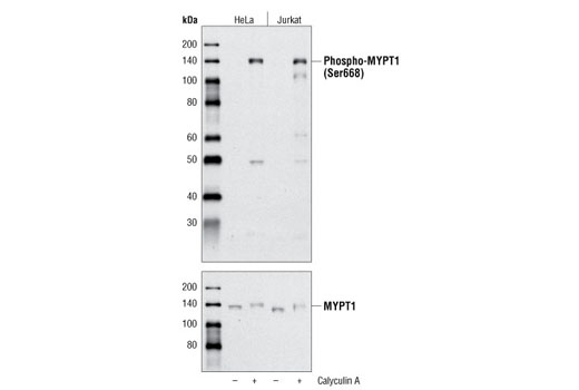 Western blot analysis of extracts from HeLa and Jurkat cells, untreated or treated with Calyculin A #9902, using Phospho-MYPT1 (Ser668) Antibody (upper) or total MYPT1 Antibody #2634 (lower).
