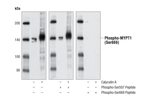 Western blot analysis of extracts from HeLa cells, untreated or treated with Calyculin A #9902, using Phospho-MYPT1 (Ser668) Antibody. The phospho-specificity of the antibody was verified by peptide blocking using no peptide (left), phospho-Ser507 peptide (middle) or phospho-Ser668 peptide (right).