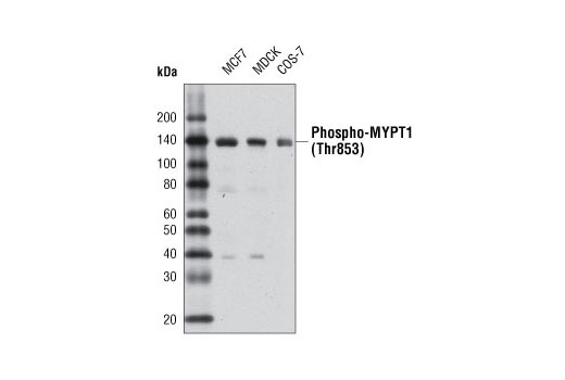 Western blot analysis of extracts from various cell types using Phospho-MYPT1 (Thr853) Antibody.