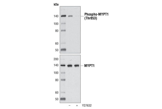 Western blot analysis of extracts from C2C12 cells, untreated or treated with with the ROCK inhibitor Y27632 using Phospho-MYPT1 (Thr853) Antibody (upper) or MYPT1 Antibody #2634 (lower).
