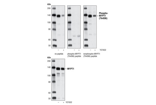 Western blot analysis of extracts from 293 cells, untreated or treated with the ROCK inhibitor Y27632 (2 minutes at 10 μM) using Phospho-MYPT1 (Thr696) Antibody or total MYPT1 Antibody #2634. Phospho-MYPT1 (Thr696) Antibody was pre-incubated as indicated with phospho-MYPT1 (Thr696) peptide or nonphospho-MYPT1 (Thr696) peptide.