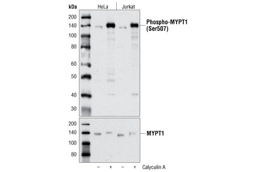 Western blot analysis of extracts from HeLa and Jurkat cells, untreated or treated with calyculin A #9902, using Phospho-MYPT1 (Ser507) Antibody (upper) or MYPT1 Antibody #2634 (lower).