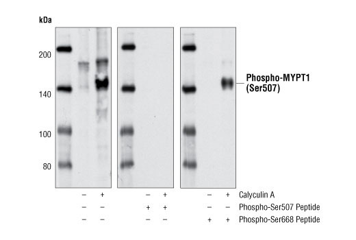 Western blot analysis of extracts from HeLa cells, untreated or treated with Calyculin A #9902, using Phospho-MYPT1 (Ser507) Antibody. The phospho-specificity of the antibody was verified by peptide blocking using no peptide (left), phospho-Ser507 peptide (middle) or phospho-Ser668 peptide (right).