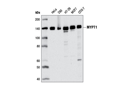 Western blot analysis of extracts from various cell lines using MYPT1 (D6C1) Rabbit mAb.
