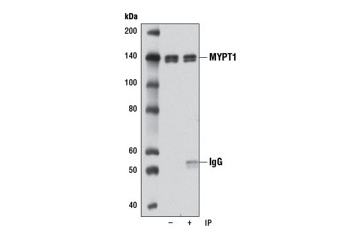 Immunoprecipitation of MYPT1 from HeLa cell extracts using MYPT1 (D6C1) Rabbit mAb (lane 2). Western blot was performed using the same antibody. Lane 1 is 10% input.