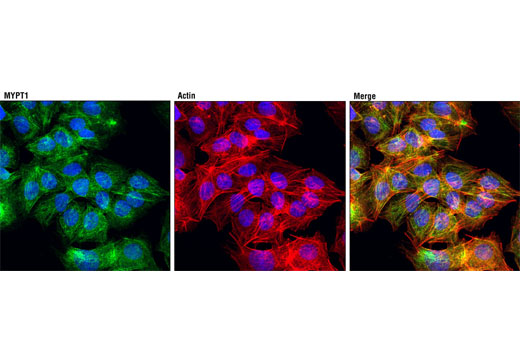 Confocal immunofluorescent analysis of Hep G2 cells using MYPT1 (D6C1) Rabbit mAb (green). Actin filaments were labeled with DY-554 phalloidin (red). Blue pseudocolor = DRAQ5 ® #4084 (fluorescent DNA dye).