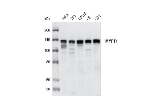 Western blot analysis of extracts from various cell types using MYPT1 Antibody.