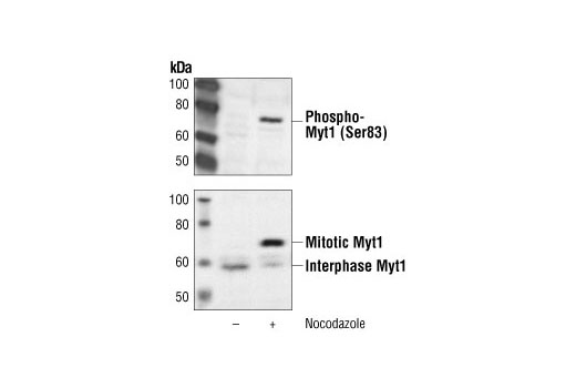 Western blot analysis of extracts from HT29 cells, untreated or nocodazole-treated (50ng/ml), using Phospho-Myt1 (Ser83) Antibody (upper) or Myt1 Antibody #4282 (lower).