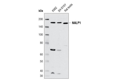 Western blot analysis of extracts from K-562 and SH-SY5Y cells and from rat testis using NALP1 Antibody.