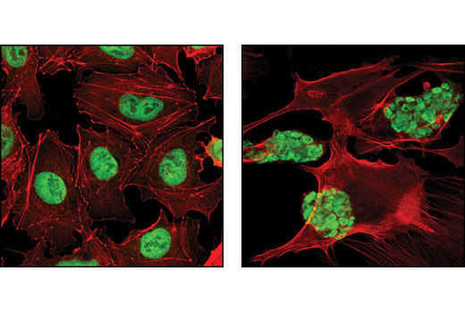 Confocal immunofluorescent analysis of NTERA2 (left) and mouse embryonic stem (mES) cells growing on mouse embryonic fibroblast (MEF) feeder cells (right) using Oct-4A (C30A3) Rabbit mAb (green). Actin filaments have been labeled with DY-554 phalloidin (red).